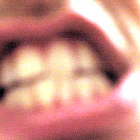 A picture of my mouth--how charming!